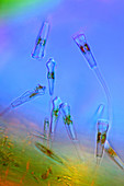 Gomphonema diatoms,light micrograph