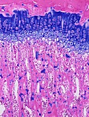 Bone growth plate,light micrograph