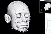 Digital forensic facial reconstruction