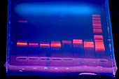 DNA electrophoresis under UV light