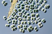 Chroococcus cyanobakteria,LM