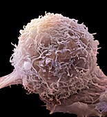 Skin cancer cell,SEM