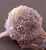 Skin cancer cell,SEM