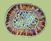 Hakea drupacea leaf,light micrograph