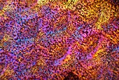 Sole skin,polarised light micrograph