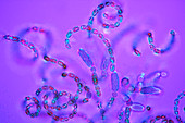 Anabaena cyanobacteria,light micrograph