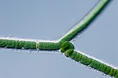 Calothrix cyanobacterium,LM