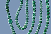 Anabena cyanobacterium,LM