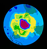 Total ozone map,south polar plot,8 October 1995