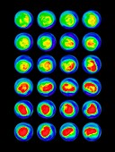 Water vapour maps of Antarctica