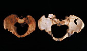 Fossilised pelvis,Sima de los Huesos