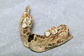 Human jaw fossil