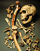 Fossil skull and bones of Neanderthal man