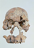 Front view of skull of Homo habilis (KNM-ER 1470)