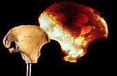 Male hominine hip bone,KNM-ER 3228