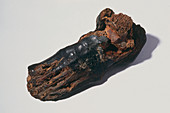 The foot of an Egyptian mummy