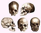 Early human skulls