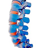 Lumbar spine,computer artwork