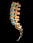 Lumbar spine and sacrum,computer artwork
