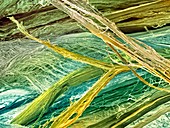 Tendon fibres,SEM