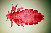 LM of a female human body louse,Pediculus humanis