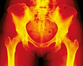 Normal female pelvis,X-ray