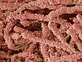 Plaque-forming bacteria,SEM