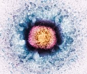Vaccinia virus particle,TEM