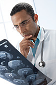 Doctor examining MRI scans