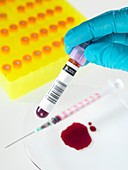 Blood research