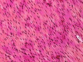 Smooth muscle,light micrograph