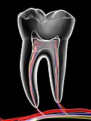 Molar tooth