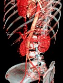 Normal abdomen,3D CT scan