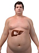 Obese man's liver,artwork