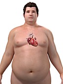 Obese man's heart,artwork