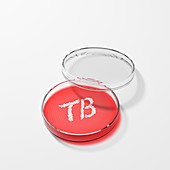 Tuberculosis bacteria in a petri dish