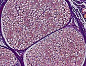 Nerve fibres,light micrograph