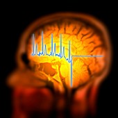 ECG trace and mri brain scan,artwork