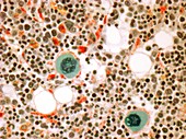 Bone marrow,light micrograph