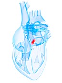 Aortic valve,artwork