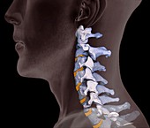 Normal neck bones,3D CT scan