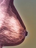 Normal mammogram