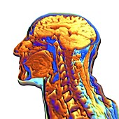 Coloured MRI scan of the human head