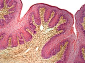 Vaginal mucosa,light micrograph