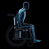 Man in a wheelchair,artwork