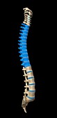 Thoracic spine,artwork