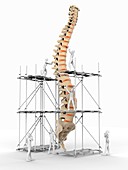 Spine with workers,spine repair