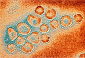 TEM of a cluster of corona viruses