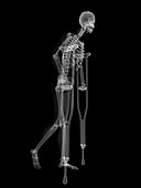 Skeleton on crutches,artwork