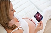 Pregnant woman with baby scan